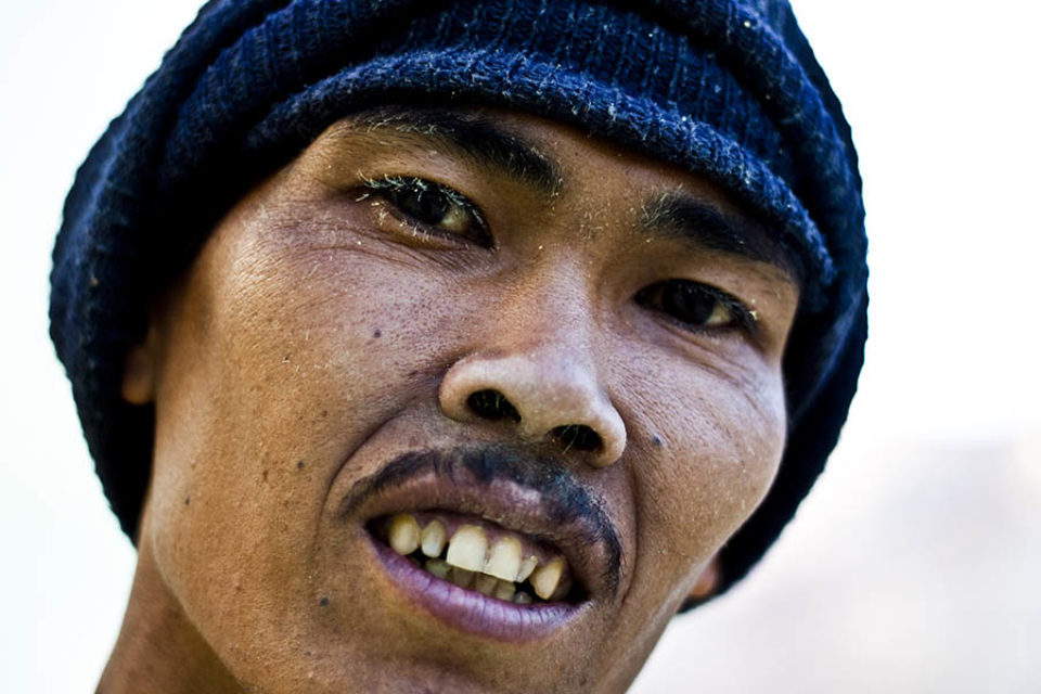 Close-up of sulphur flakes on miner's face